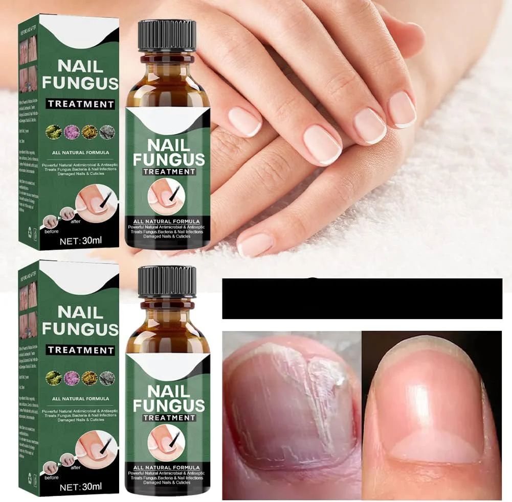 NagelFix™ – Voor verzorgde nagels & nieuw zelfvertrouwen [1 + 1 Gratis]