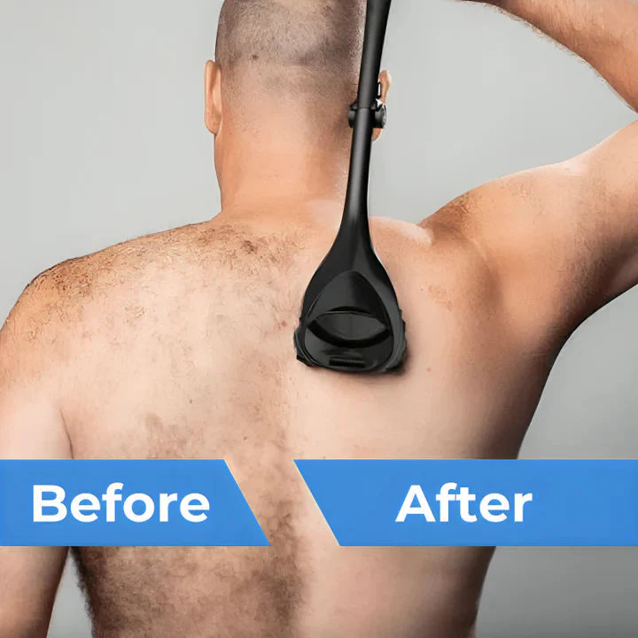 SmoothBack™ – Perfecte rugverzorging voor meer comfort en welzijn [50% Korting]